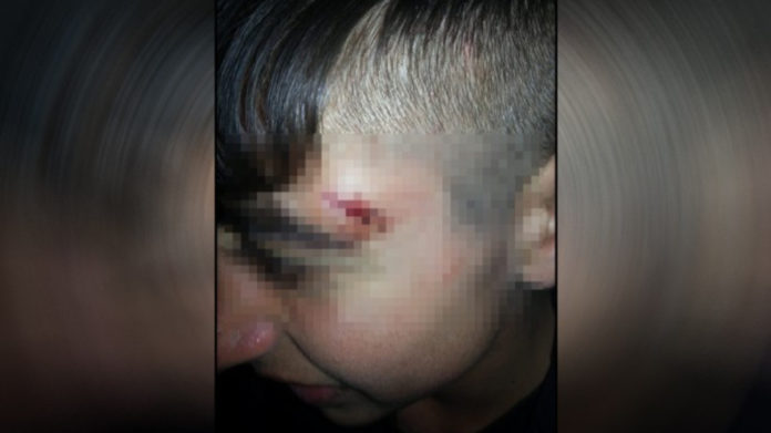 Un garçon de 15 ans battu de nouveau pour avoir dénoncé la violence policière dont il avait été victime