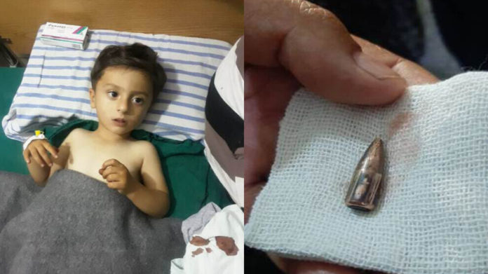 Un enfant de 3 ans a été blessé lors des bombardements de l’Etat turc et ses mercenaires, jeudi soir dans le district de Sherawa.