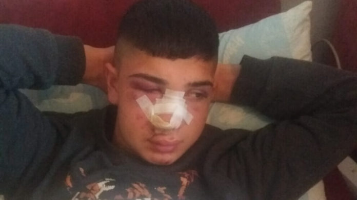 Un jeune homme d’origine kurde a été victime d'une attaque raciste à coups de couteaux et de bâtons dans la capitale turque d’Ankara. Volkan Temel, 17 ans, d’origine kurde qui vit dans le quartier de Türközü à Mamak, a été victime d’une attaque raciste perpétrés par 3 personnes. Alors que deux des agresseurs ont pu être identifié le troisième reste toujours non identifié.