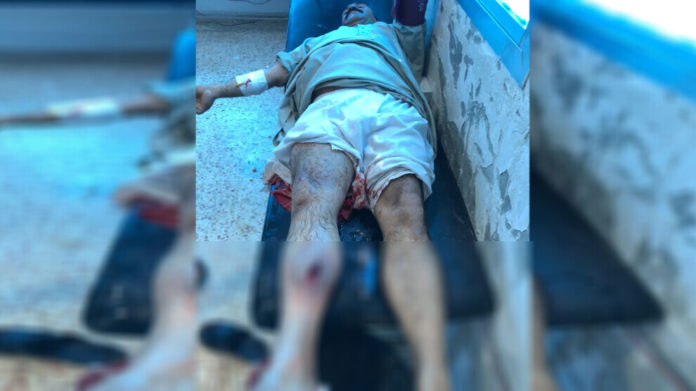 À Aïn Issa, au nord de la Syrie, un homme de 50 ans a été blessé ce lundi par un sniper appartenant aux forces djihadistes pro-turques.