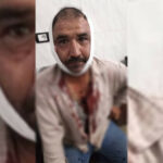 L’armée turque multiplie ses attaques sur Afrin et Shehba L'armée turque a intensifié ses attaques contre le nord de la Syrie, où elle a déjà occupé des territoires en violation du droit international.