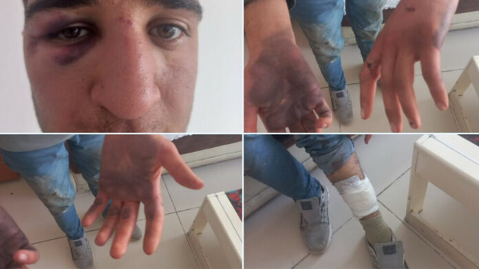 Brindar Gezici, membre de la jeunesse du DEM, a été torturé pendant deux jours par des militaires turcs à Agri